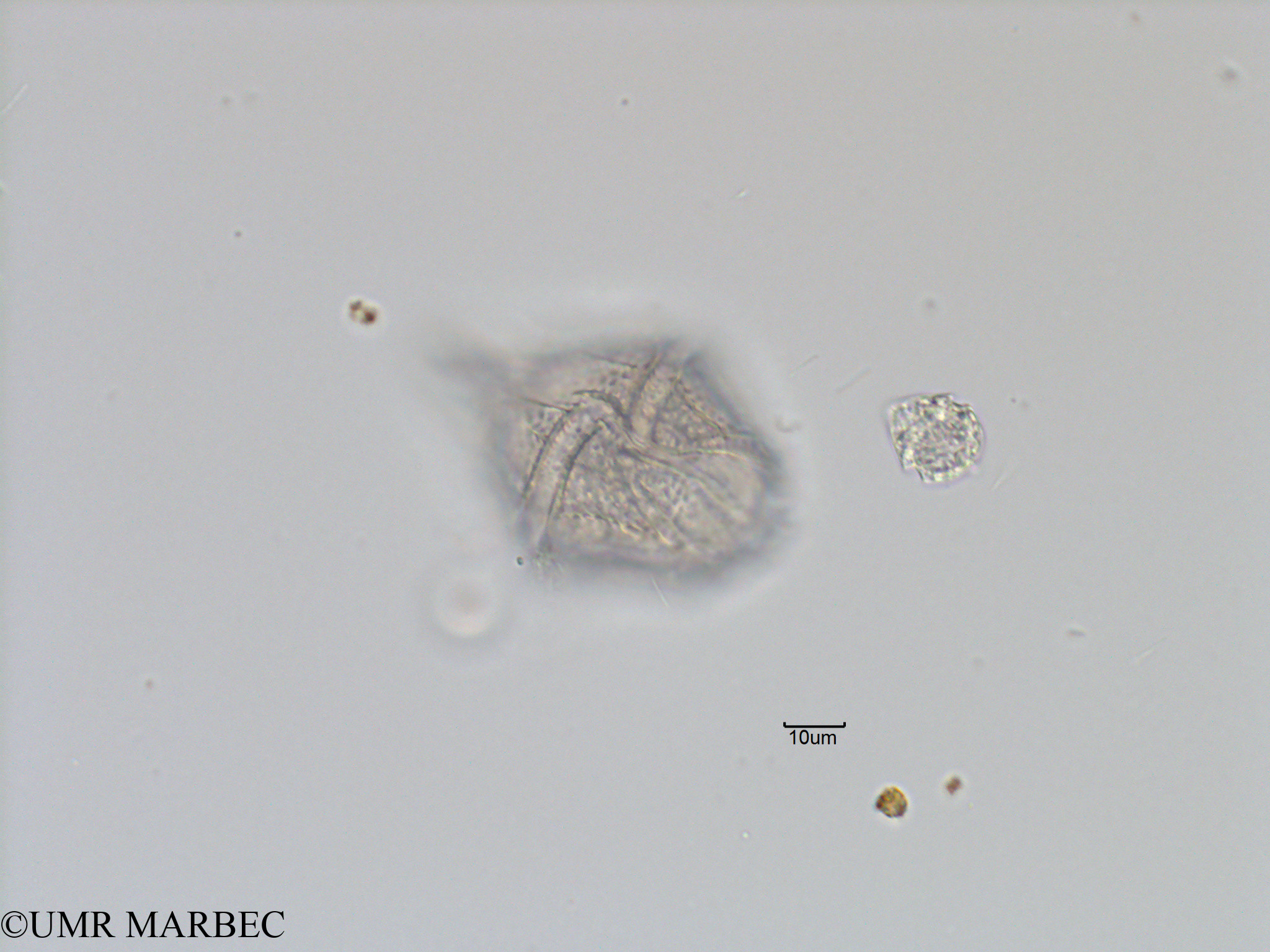 phyto/Bizerte/bizerte_bay/RISCO November 2015/Gonyaulax digitale (Baie_T5-C2-3 Gonyaulax spinifera-5).tif(copy).jpg